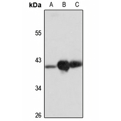 B4GALT4 Rabbit Polyclonal Antibody