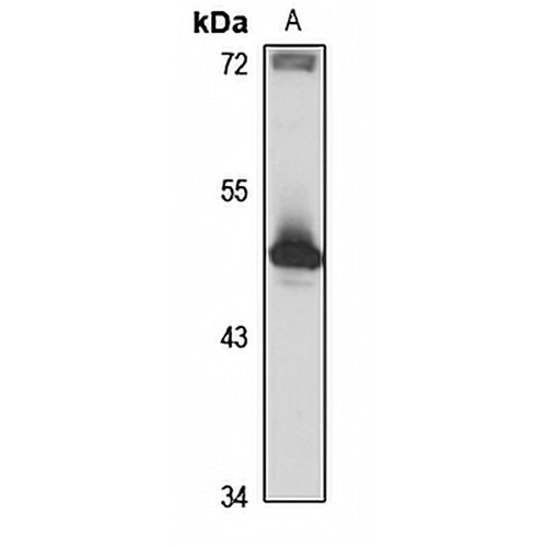 BBS5 Rabbit Polyclonal Antibody