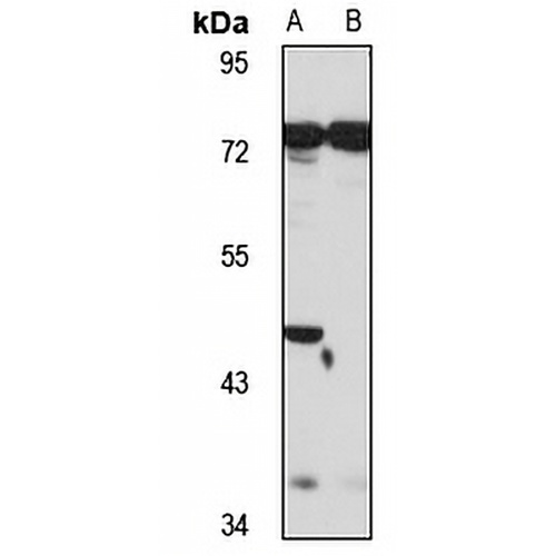 BCMO1 Rabbit Polyclonal Antibody