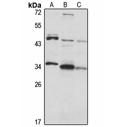 BIN3 Rabbit Polyclonal Antibody