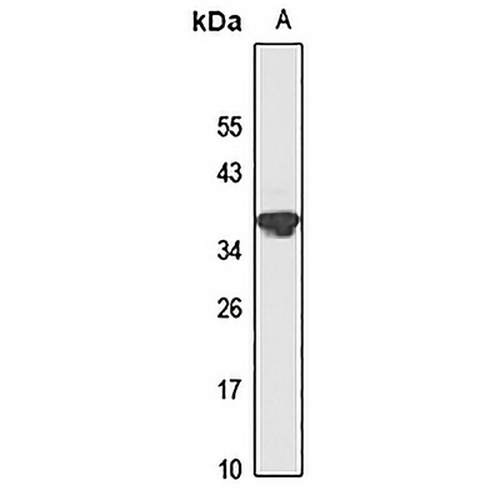 BLVRA Rabbit Polyclonal Antibody