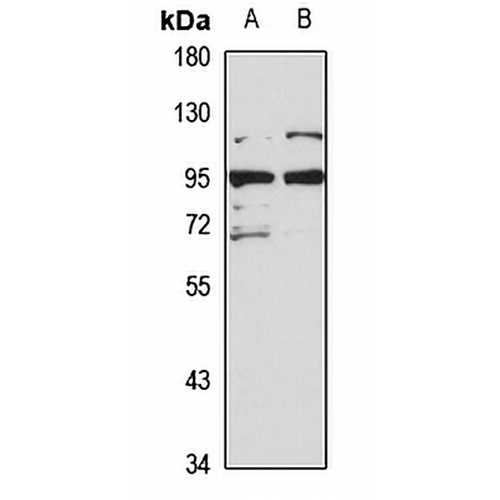 BRAT1 Rabbit Polyclonal Antibody
