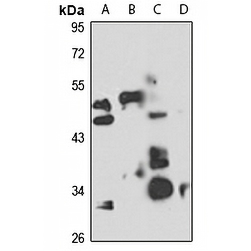 BRCC3 Rabbit Polyclonal Antibody