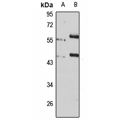 BRF2 Rabbit Polyclonal Antibody