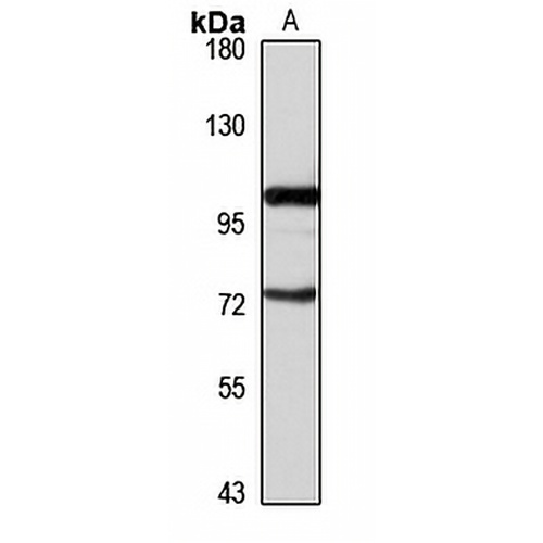 DBC1 Rabbit Polyclonal Antibody