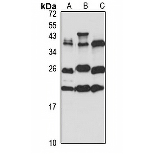 BTF3 Rabbit Polyclonal Antibody