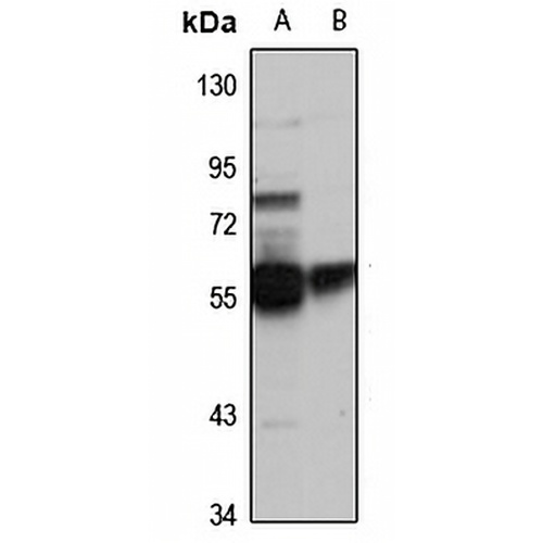 CACNB4 Rabbit Polyclonal Antibody
