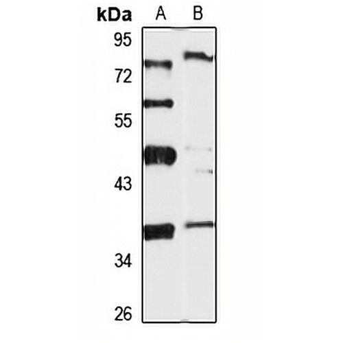 CALHM2 Rabbit Polyclonal Antibody