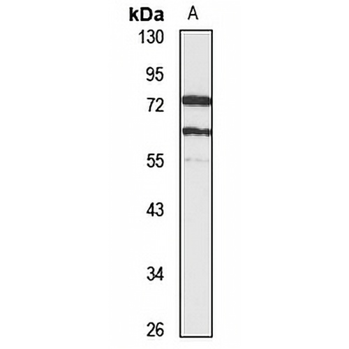 CaMKK alpha Rabbit Polyclonal Antibody