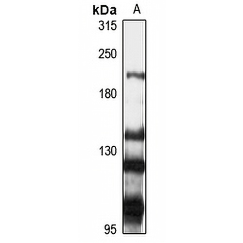 CAMSAP1L1 Rabbit Polyclonal Antibody