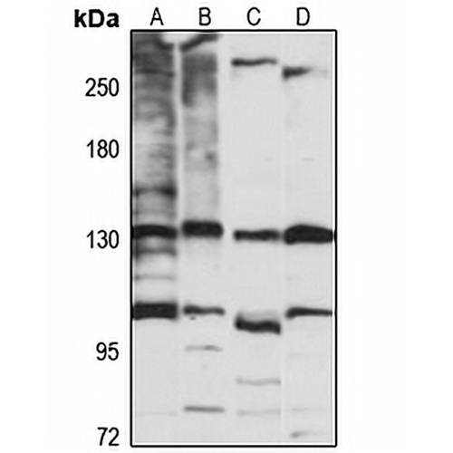 TIP120A Rabbit Polyclonal Antibody