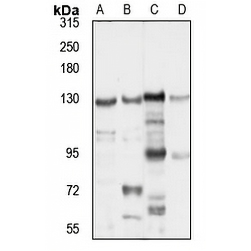 TIP120B Rabbit Polyclonal Antibody