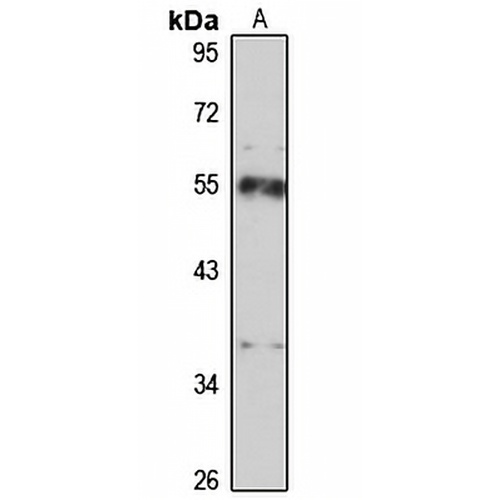 CAP2 Rabbit Polyclonal Antibody