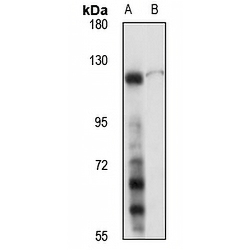 c-CBL Rabbit Polyclonal Antibody