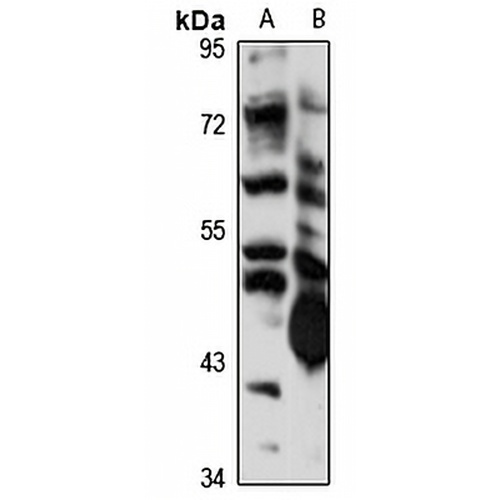 CBLL1 Rabbit Polyclonal Antibody