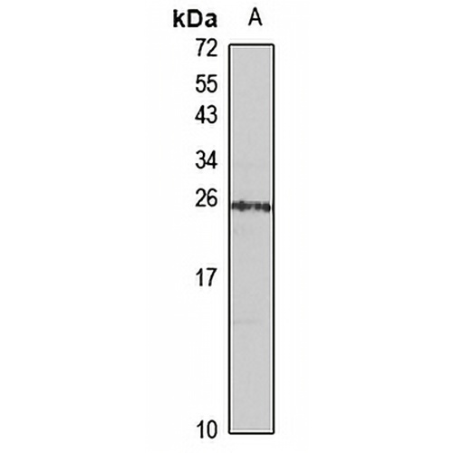 HP1 beta Rabbit Polyclonal Antibody