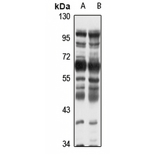 CBX2 Rabbit Polyclonal Antibody