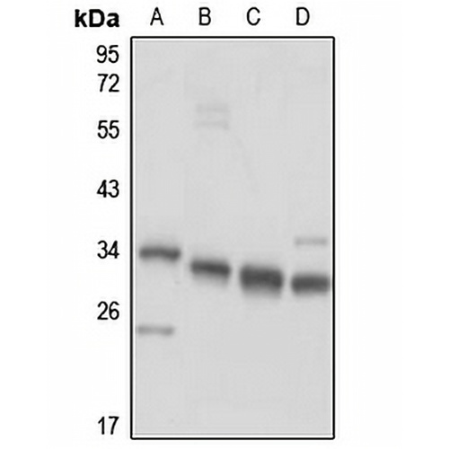 CCDC124 Rabbit Polyclonal Antibody