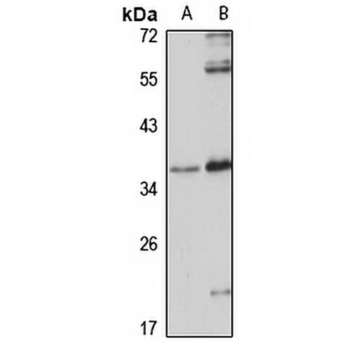 CCDC137 Rabbit Polyclonal Antibody