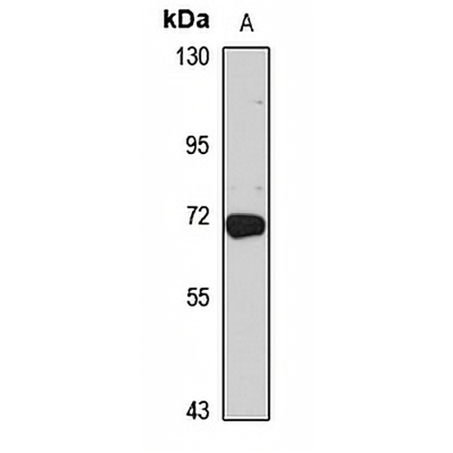 CCDC61 Rabbit Polyclonal Antibody