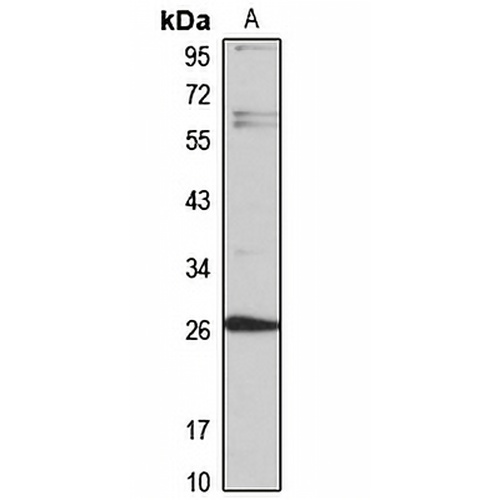 CCDC70 Rabbit Polyclonal Antibody