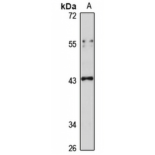 CCR7 Rabbit Polyclonal Antibody