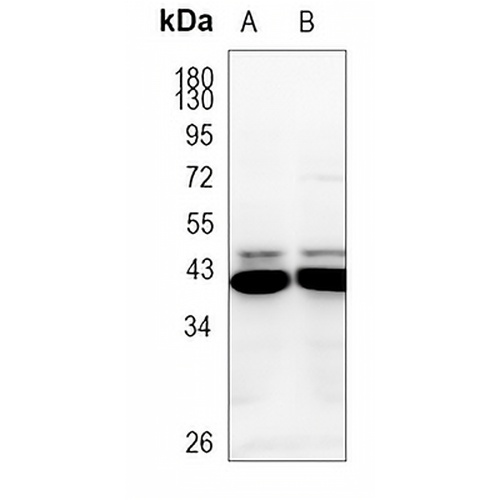 CCR9 Rabbit Polyclonal Antibody