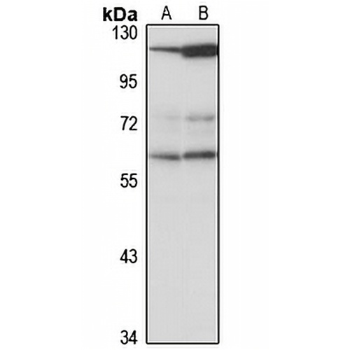 CCT6B Rabbit Polyclonal Antibody