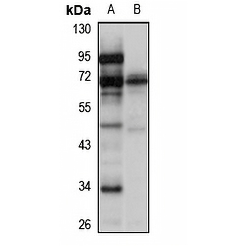 CAST Rabbit Polyclonal Antibody