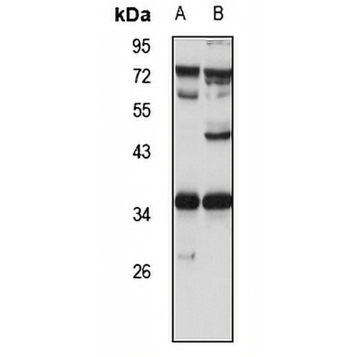 Sororin Rabbit Polyclonal Antibody