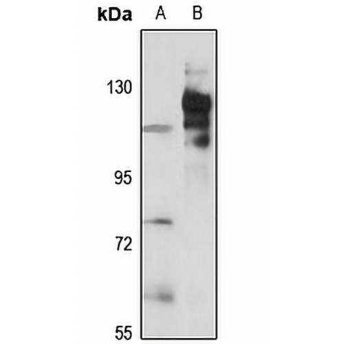 P Cadherin Rabbit Polyclonal Antibody