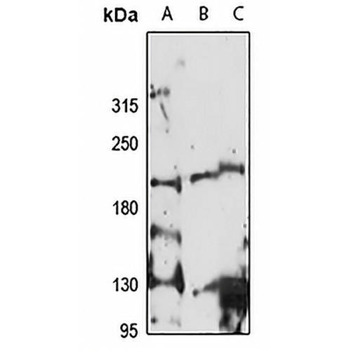 CDK12 Rabbit Polyclonal Antibody