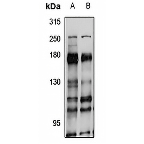 CDC2L5 Rabbit Polyclonal Antibody