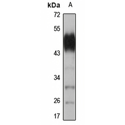 CDK14 Rabbit Polyclonal Antibody