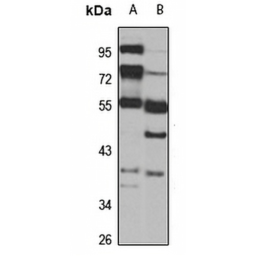 CDK16 Rabbit Polyclonal Antibody