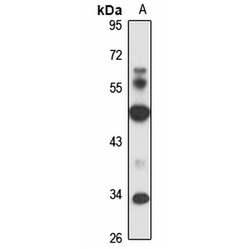 CDK18 Rabbit Polyclonal Antibody
