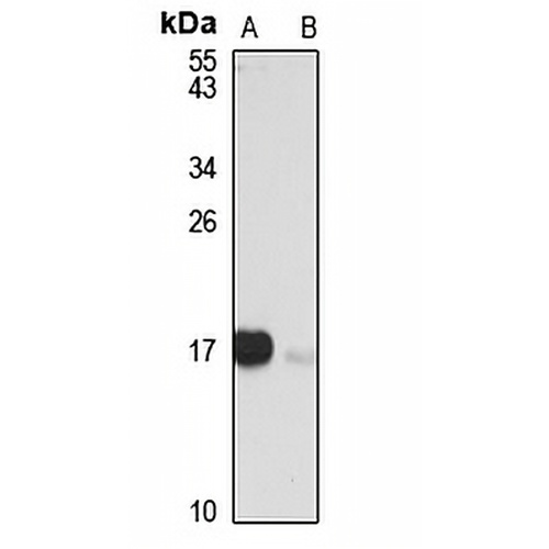 p16 INK4a Rabbit Polyclonal Antibody