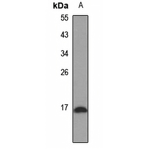 p16 INK4a Rabbit Polyclonal Antibody