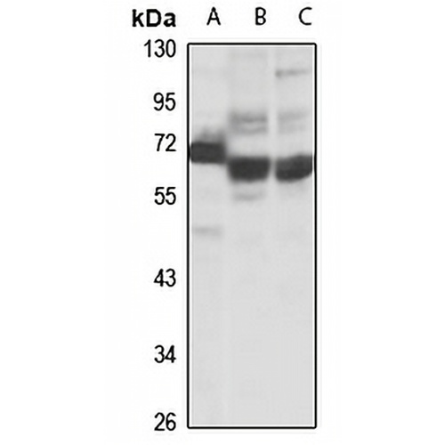CDKN2AIP Rabbit Polyclonal Antibody