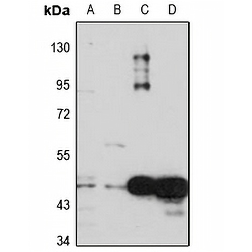 CDSN Rabbit Polyclonal Antibody