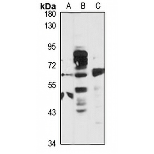CDY2B Rabbit Polyclonal Antibody