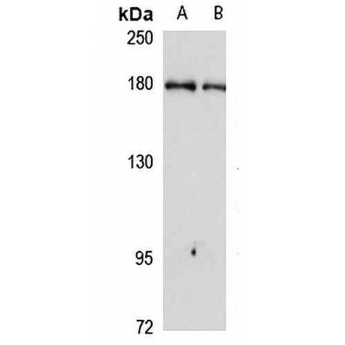 CEMIP Rabbit Polyclonal Antibody