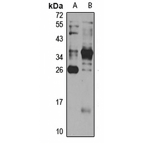 CENPH Rabbit Polyclonal Antibody