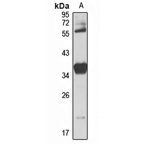 CENPK Rabbit Polyclonal Antibody