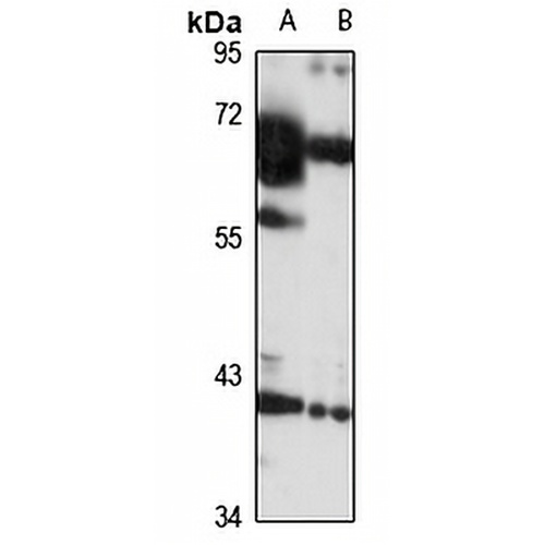 CENPN Rabbit Polyclonal Antibody