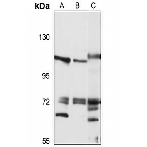 CEP112 Rabbit Polyclonal Antibody