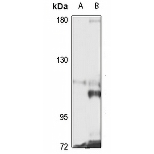 CEP120 Rabbit Polyclonal Antibody