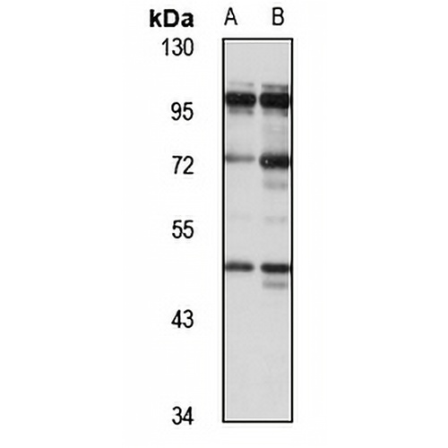 CEP85 Rabbit Polyclonal Antibody