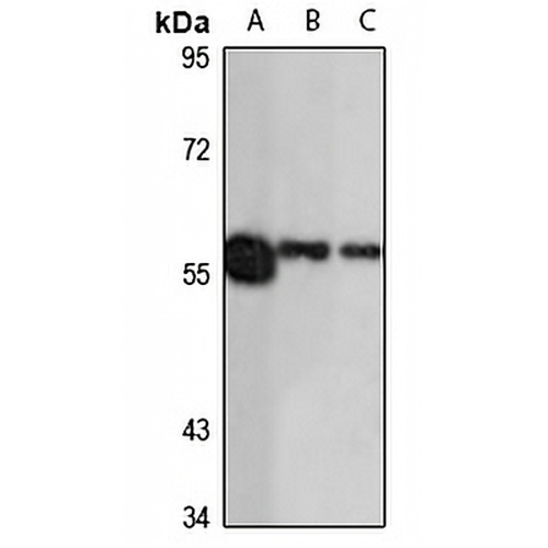CES3 Rabbit Polyclonal Antibody