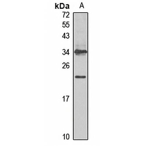 CGB3 Rabbit Polyclonal Antibody
